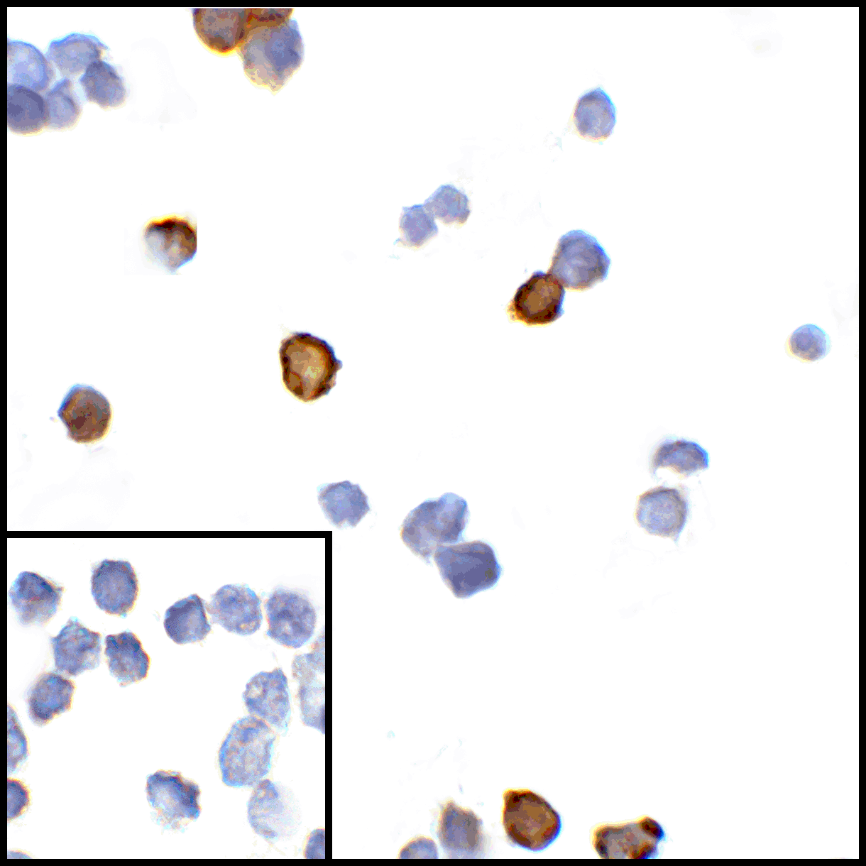 CTLA4 / CD152 Antibody (clone 8A1)
