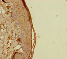 REEP5 Antibody