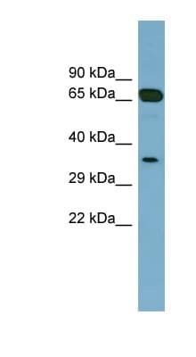 HC71 / GLOD4 Antibody (aa143-192)
