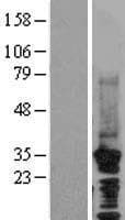 CDC73 / Parafibromin Protein (Over-Expression Lysate Myc-DDK (Flag))