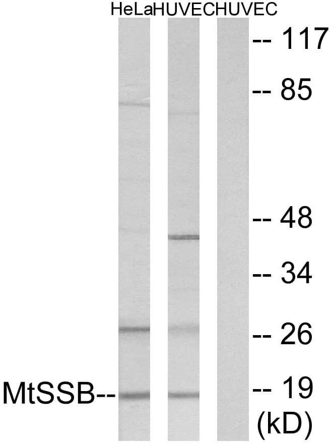 SSBP1 / mtSSB Antibody (aa99-148)