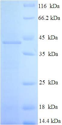 Human RAB3C Protein (Recombinant His-SUMO)