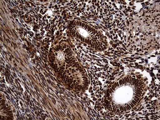 RAD21 Antibody (aa193-458, clone OTI6C10, Carrier-free)