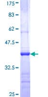 Human CNKSR1 Protein (Recombinant GST, N-terminus)