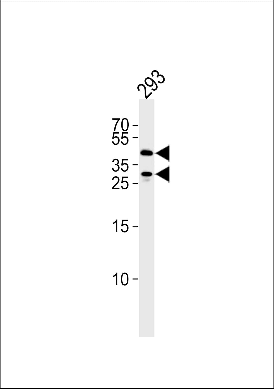 SIRT3 / Sirtuin 3 Antibody (aa250-279)
