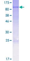Human CPT2 Protein (Recombinant GST)