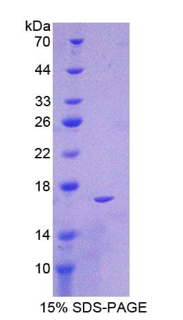 Mouse G6PD Protein (Recombinant His-T7)