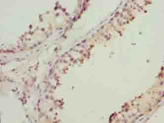 Polyclonal Rabbit anti-Human MRPL41 / PIG3 / BMRP Antibody (IHC)