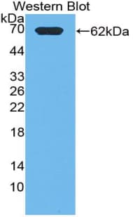 PIK3C2A Antibody (aa349-611)