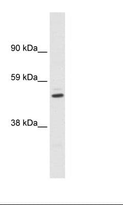 Polyclonal Rabbit anti-Human KCNAB1 Antibody (aa311-360, WB)