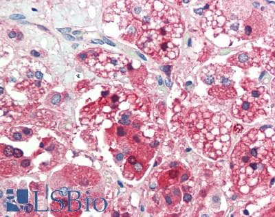 IHC-plus™ GSTA3 Antibody