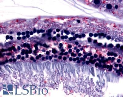 IHC-plus™ Polyclonal Rabbit anti-Human GPR75 Antibody (N-Terminus, IHC)