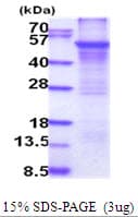 Human CYP2E1 Protein (Recombinant His)