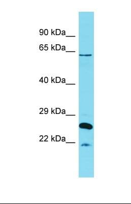 HCF1 / HCFC1 Antibody (N-Terminus)