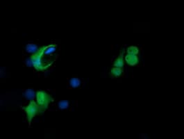 PADI4 / PAD4 Antibody (clone OTI3E1)