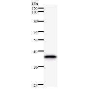NR4A2 / NURR1 Antibody (clone 447C2a)