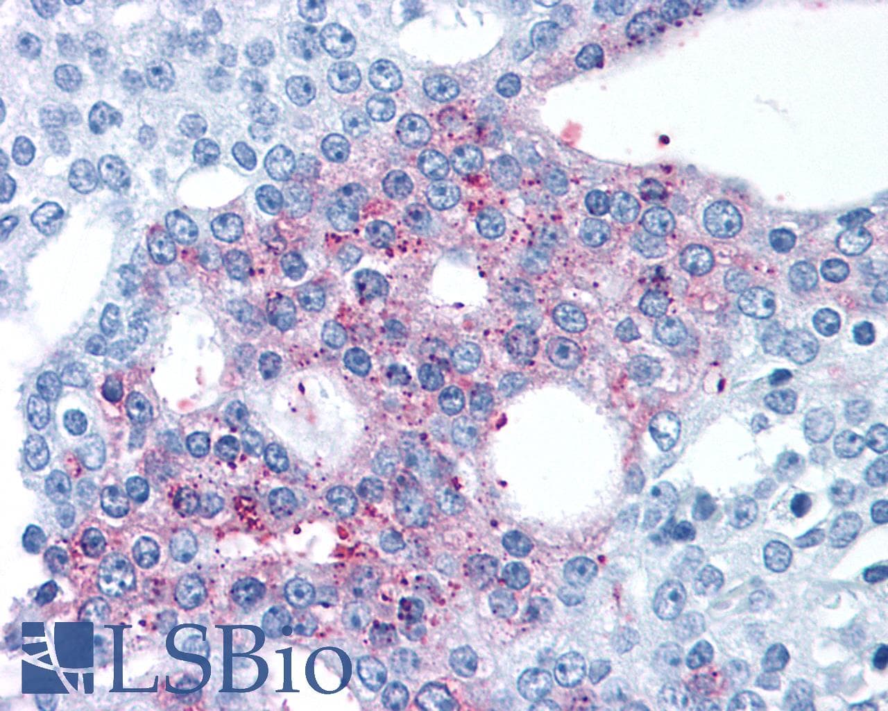 PathPlus™ GPRC6A Antibody (N-Terminus)
