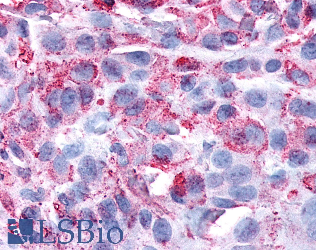 PathPlus™ FAK / Focal Adhesion Kinase Antibody (C-Terminus)