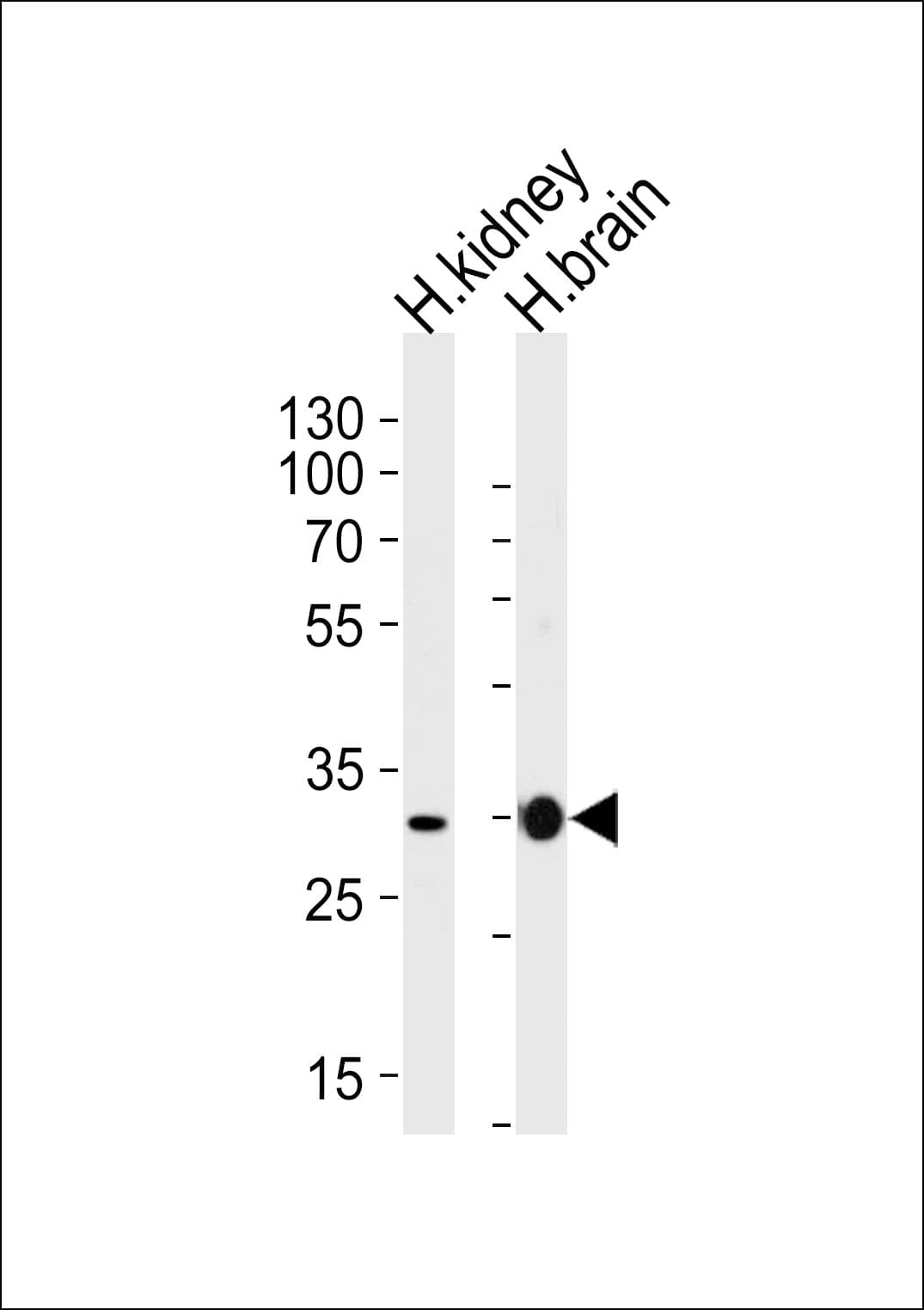 Polyclonal Rabbit anti-Human PRRG3 / TMG3 Antibody (aa121-150, WB)