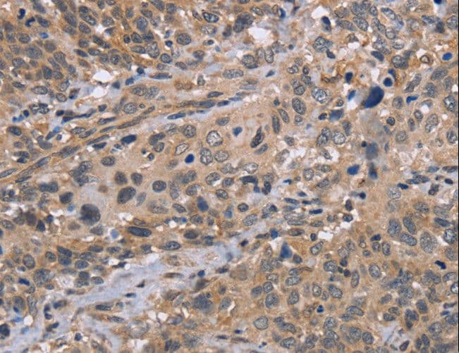 EDA / Ectodysplasin A Antibody