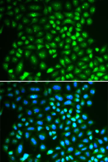 IFIH1 / MDA5 Antibody