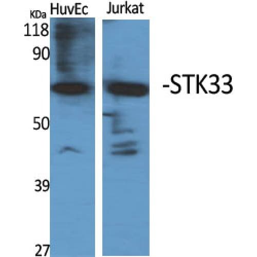 STK33 Antibody (N-Terminal)
