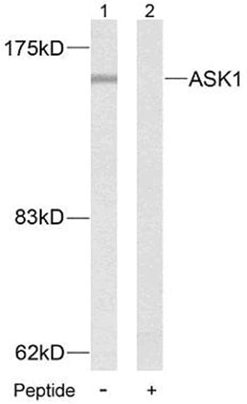 IHC-plus™ MAP3K5 / ASK1 Antibody (aa49-98)