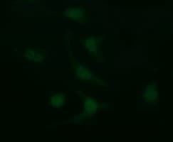 Monoclonal Mouse anti-Human LGALS3 / Galectin 3 Antibody (clone 1G8, Carrier-free, IHC, IF, WB)