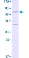 Human HDGF Protein (Recombinant GST)