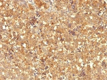 Alpha-Fetoprotein Antibody (clone MBS-12)