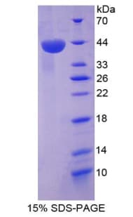 Human SDF1 / CXCL12 Protein (Recombinant His-GST)