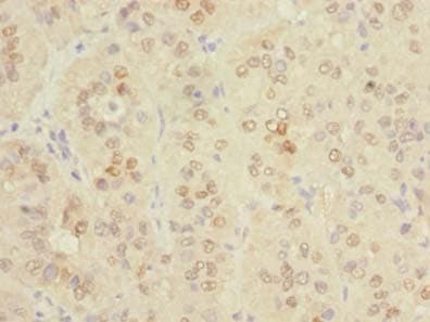 Polyclonal Rabbit anti-Human SPRYD5 Antibody (IHC, WB)