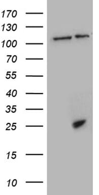 CSF3 / G-CSF Antibody (clone OTI1A9, Carrier-free)