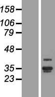 ANKRD29 Protein (Over-Expression Lysate Myc-DDK (Flag))