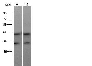MAP2K3 / MEK3 / MKK3 Antibody (Preservative Free)