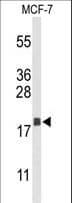 AG3 / AGR3 Antibody (aa119-147)