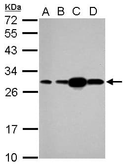 IHC-plus™ HSPB1 / HSP27 Antibody