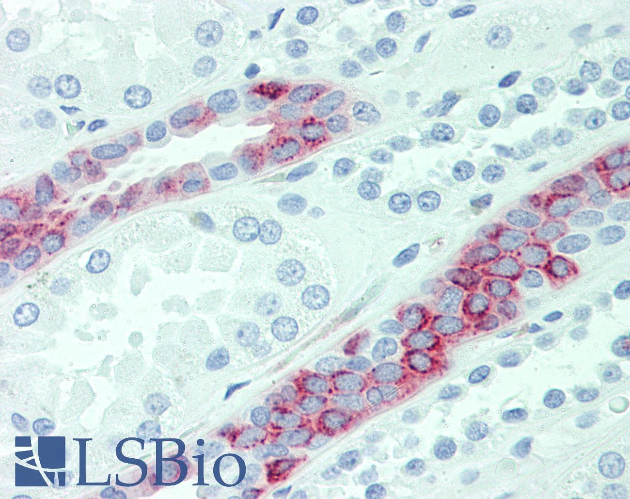 IHC-plus™ SLC4A2 / AE2 Antibody (Internal)