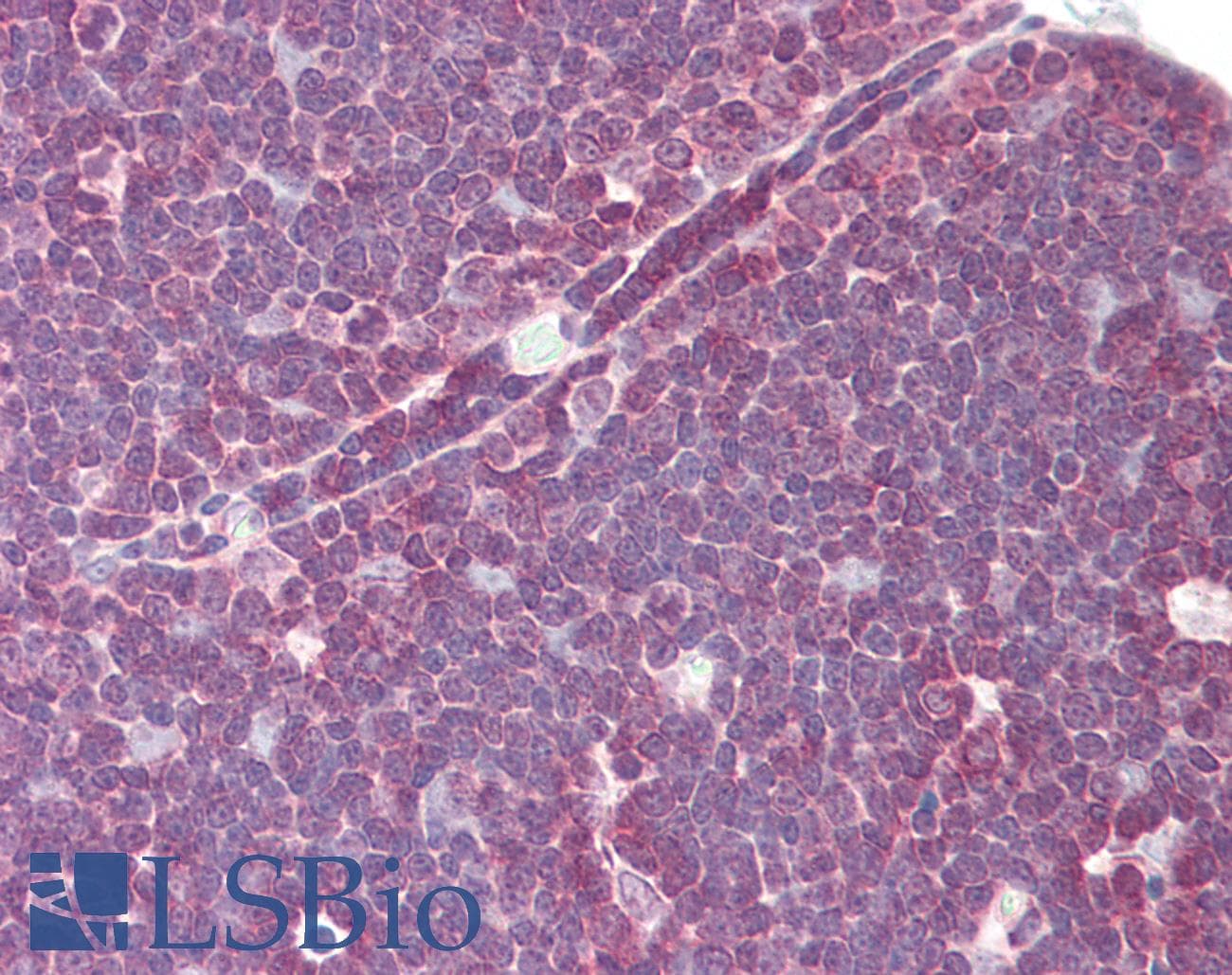 IHC-plus™ p56lck / LCK Antibody