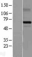 Human MDM4 / MDMX Protein (Over-Expression Lysate Myc-DDK (Flag))