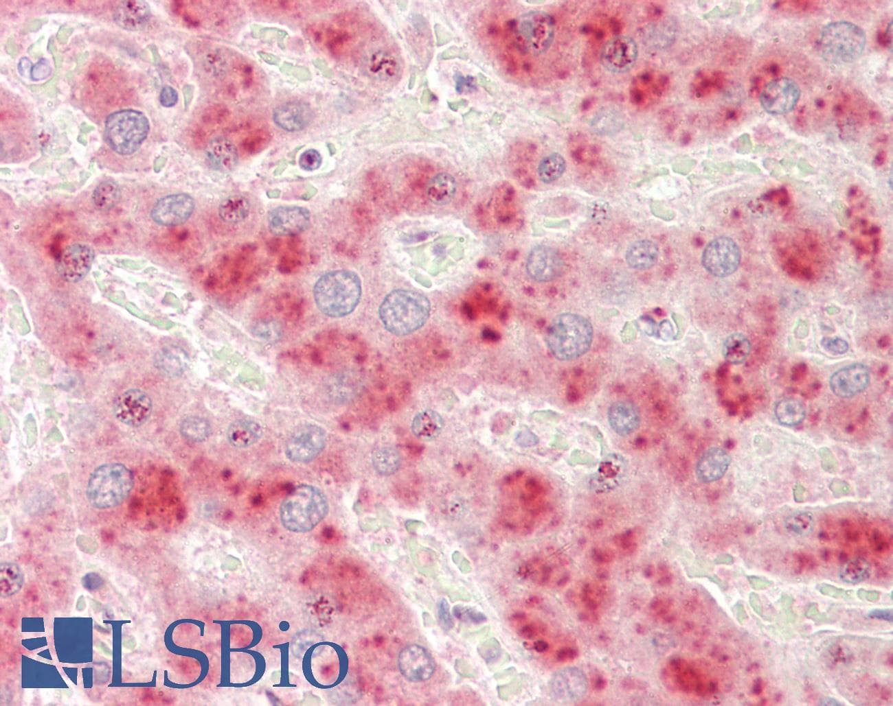 IHC-plus™ ADAMTS13 Antibody (aa250-350)