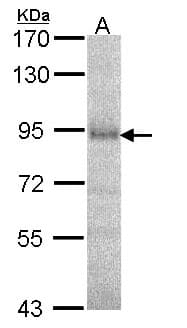 IHC-plus™ Dipeptidylpeptidase 8 / DPP8 Antibody (aa349-662)