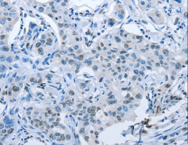 ARHGEF2 / GEF-H1 Antibody