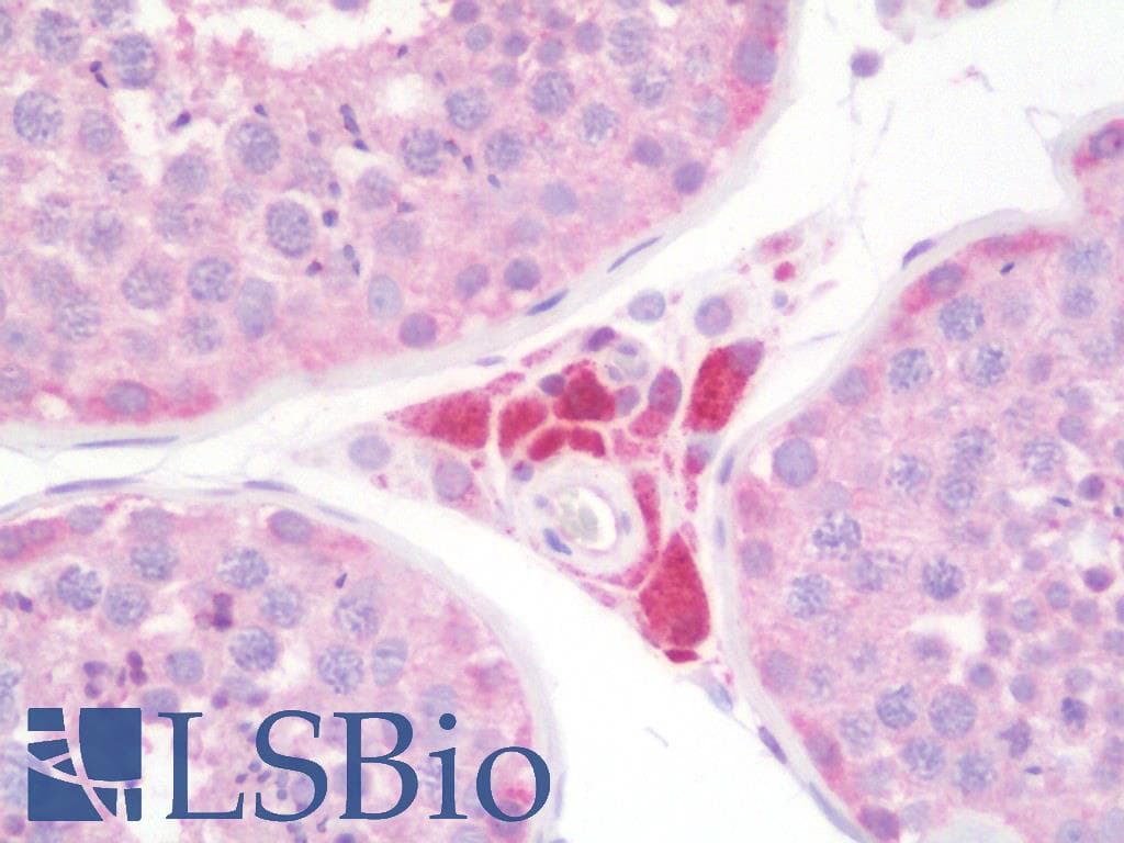 PathPlus™ Polyclonal Rabbit anti-Human MTNR1A / Melatonin Receptor 1a Antibody (Cytoplasmic Domain, IHC)