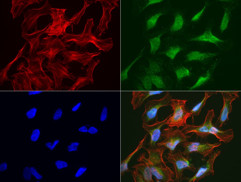 SLC7A8 / LAT2 Antibody (clone UMAB70)