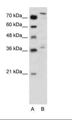 Polyclonal Rabbit anti-Human NFE2L3 Antibody (aa351-400, IHC, WB)