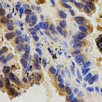 ITGB1 / Integrin Beta 1 / CD29 Antibody (C-Terminus)