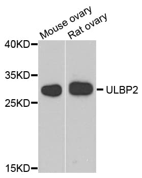 ULBP2 / RAET1H Antibody