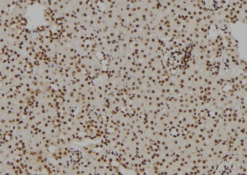GATA1 Antibody