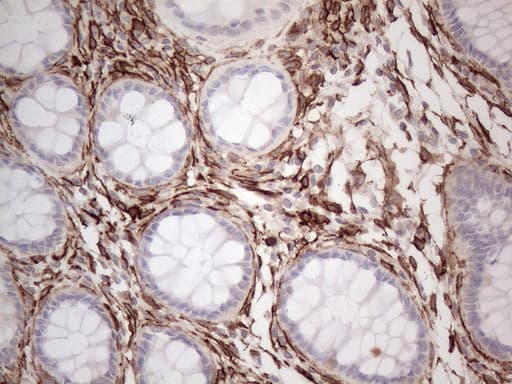 PROCR / EPCR Antibody (aa1-210, clone OTI12H5, Carrier-free)